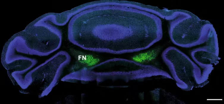 cerveau scan