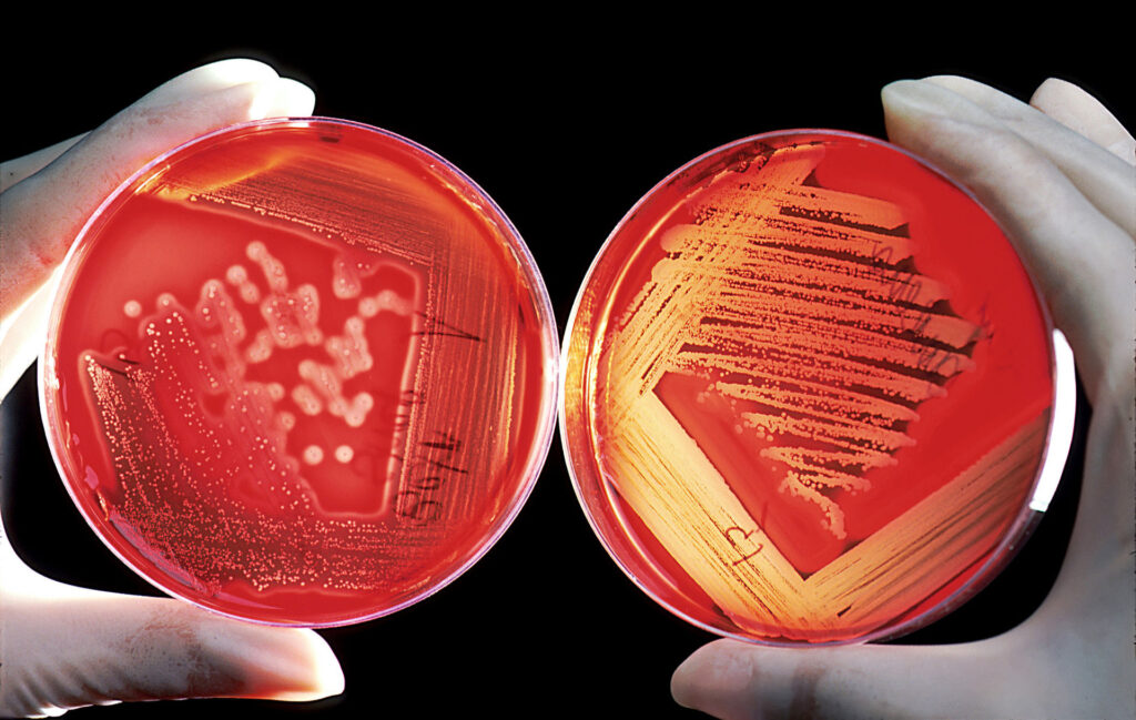 Two sides of a dish with bacteria culture on an agar gel.  // Source: Bill Branson
