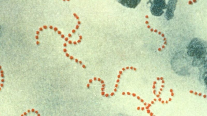 Qu’est-ce que le streptocoque A, la bactérie mortelle qui inquiète le Japon ?