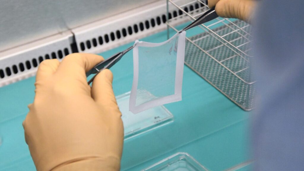 Bioprinting of skin at Conception in Marseille.  // Source: AP-HM