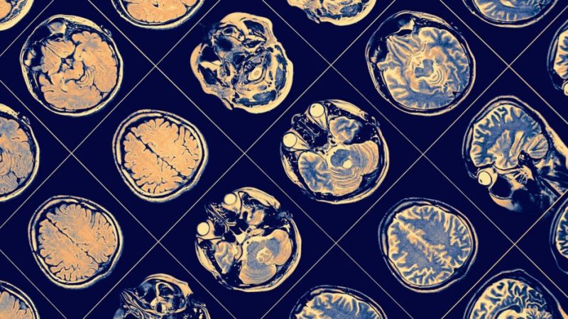 Comment la mémoire et les souvenirs sont-ils rangés dans le cerveau ?
