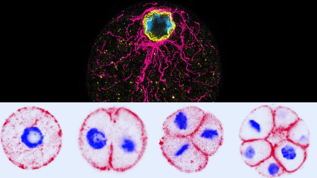 Cet organisme unicellulaire est un cousin des animaux. Il est né il y a plus d'un milliard d'années. // Source : Dudin, UNIGE