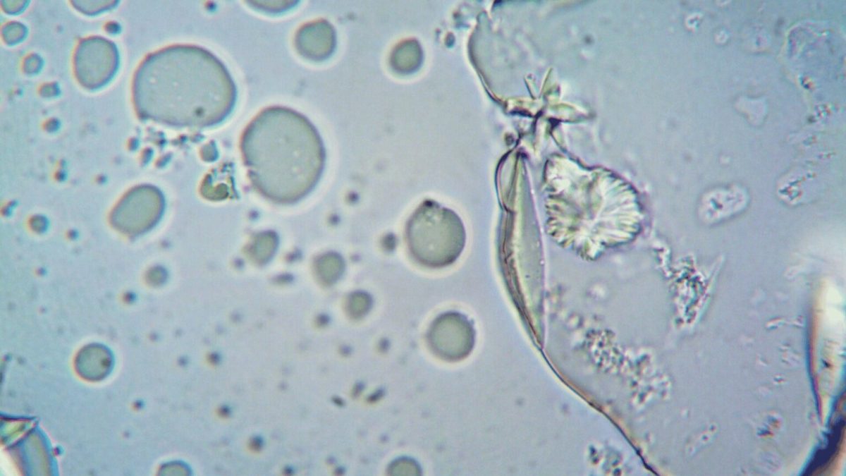 Vue microscopique d'une cellule // Source : Pexel /Libre d'utilisation