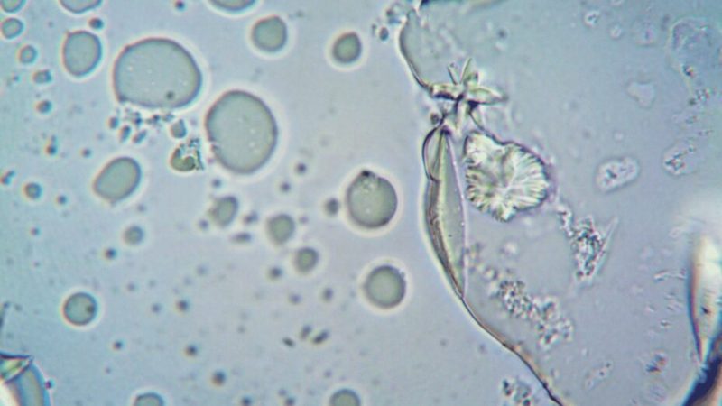 Les vertus insoupçonnées du CO2 dans nos cellules