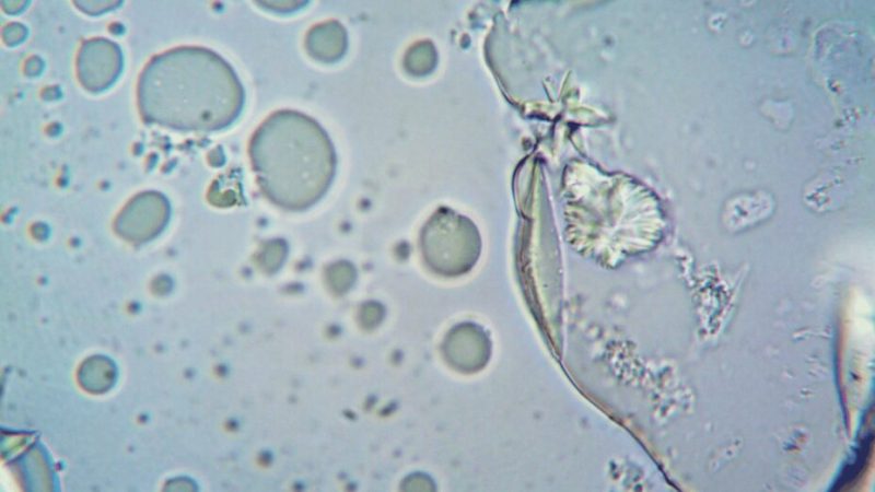 Les vertus insoupçonnées du CO2 dans nos cellules Les vertus insoupçonnées du CO2 dans nos cellules