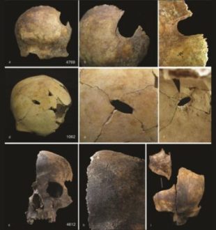 Exemples de trauma crânien // Source : Schulting et al. Antiquity, December 2024.