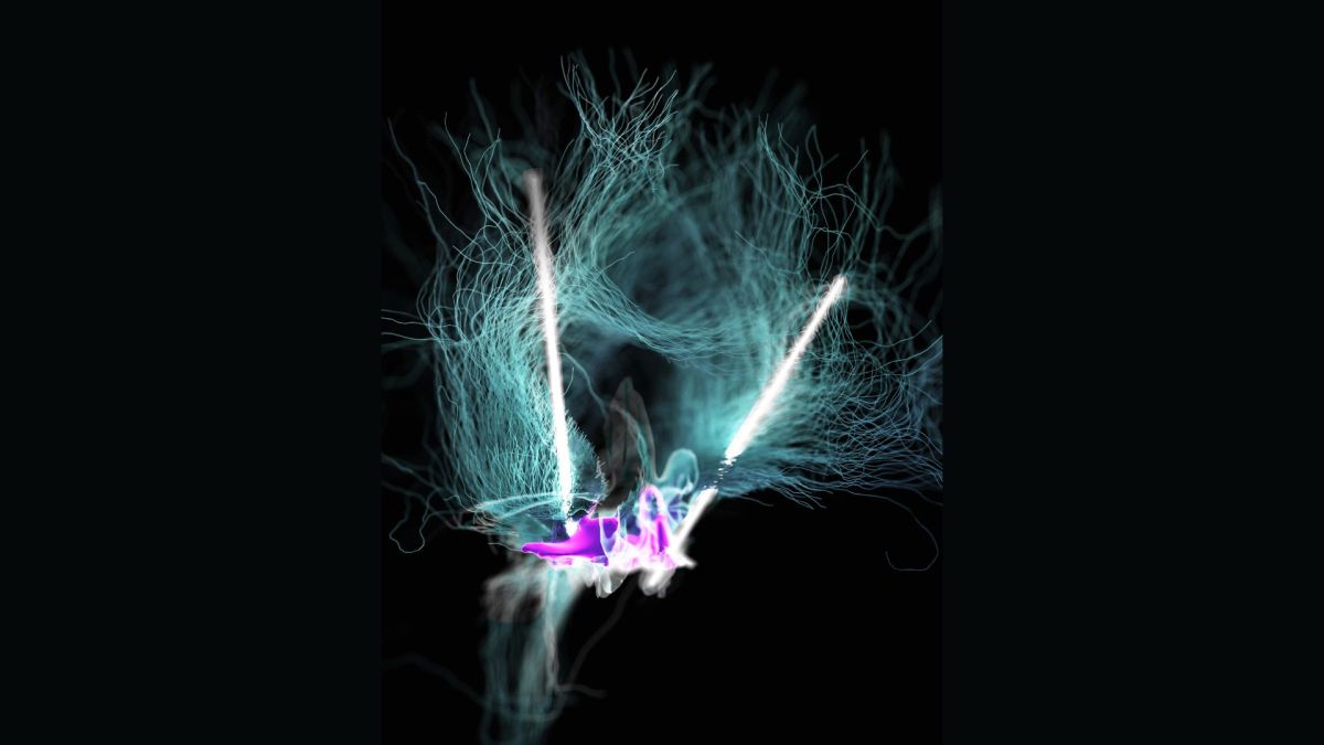 Une représentation visuelle de la stimulation cérébrale profonde de l'hypothalamus latéral dans l'étude par . NeuroRestore à l'EPFL // Source : NeuroRestore / EPFL 2024