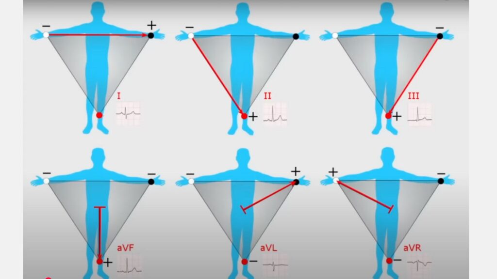 ***** // Source : Capture d'écran vidéo YT "ECG Watch: How it Works (Apple, Samsung A fib Watches / EKG)"