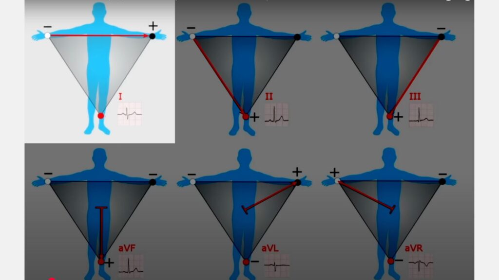 ***** // Source : Capture écran vidéo YT : "ECG Watch: How it Works (Apple, Samsung A fib Watches / EKG)"