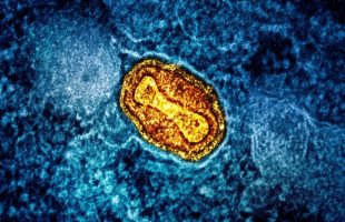 Source : NIAID (particule de mpox au microscope)