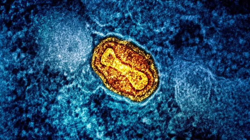 Nouveau variant du virus mpox en Bretagne : 5 questions pour comprendre