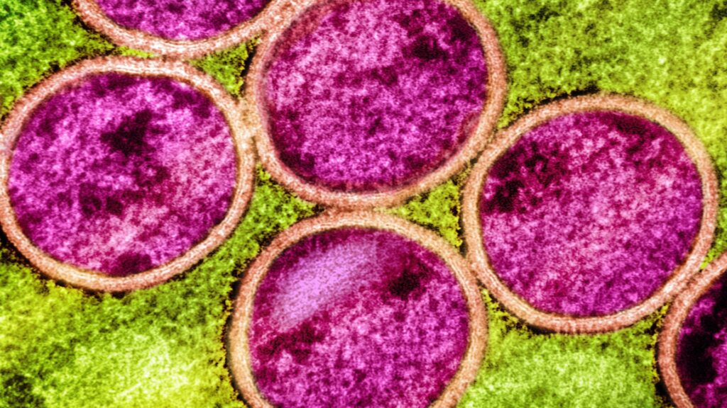 Micrographie électronique à transmission colorisée de particules immatures du virus mpox (rose avec enveloppe virale orange) trouvées dans une cellule VERO E6 infectée (verte), cultivée en laboratoire.  // Source : Image prise au NIAID Integrated Research Facility (IRF) à Fort Detrick, Maryland.