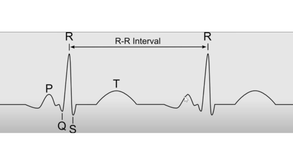 Tracé d'ECG légendé // Source : Capture d'écran vidéo YT "ECG Watch: How it Works (Apple, Samsung A fib Watches / EKG)"