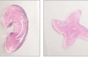 Certaines structures polymères d'hydrogel imprimées avec la technique d'impression sonore in vivo_ Recadrée // Source : Elham Davoodi and Wei Gao