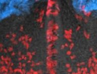 Cerveau de souris avec des cellules marquées par fluorescence // Source : Dr. Ivanovitch et al.