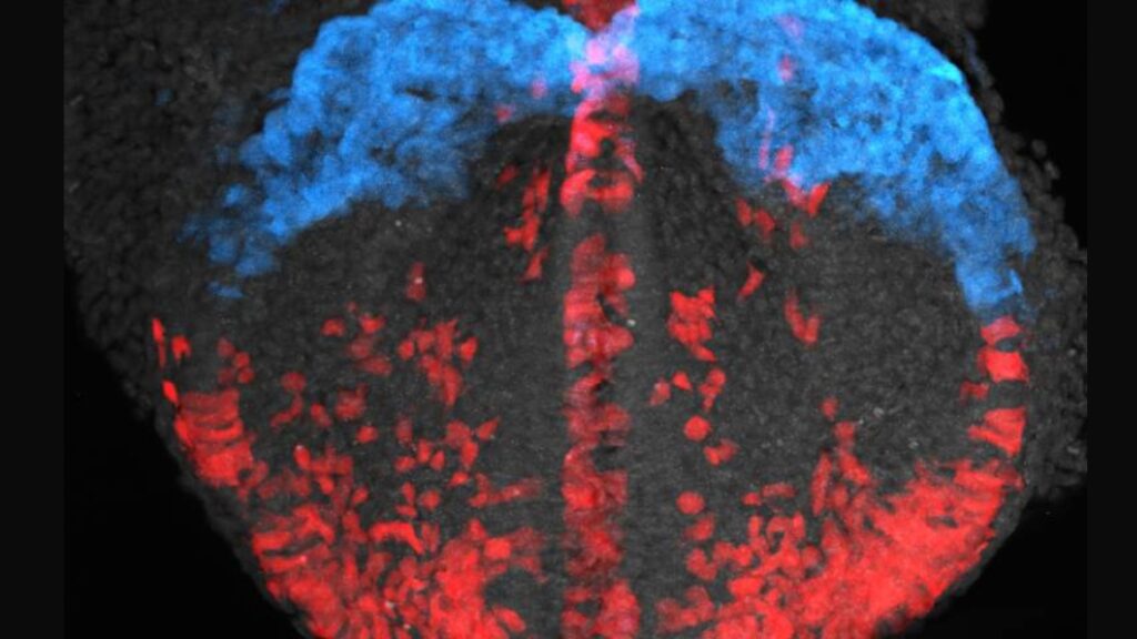 Cerveau de souris avec des cellules marquées par fluorescence // Source : Dr. Ivanovitch et al.