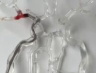 Le milli-spinner en train d'aspirer un caillot sanguin dans des tubes en plastiques // Source : Capture d'écran Nature vidéo - Ce petit appareil élimine les caillots sanguins