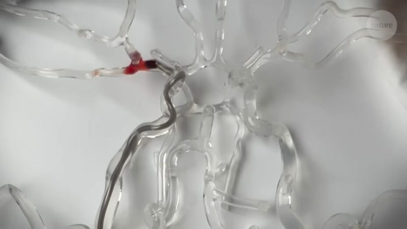 Regardez ce robot miniature déboucher des vaisseaux sanguins en un clin d’œil (vidéo)