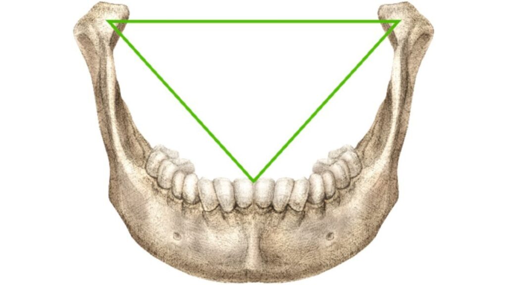 Le triangle de Bonwill en anatomie mandibulaire. Le triangle équilatéral de Bonwill en anatomie mandibulaire, démontrant la relation géométrique fondamentale régissant la fonction optimale de la mâchoire humaine établie en 1864 // Source : Rory Mac Sweeney Le triangle de Bonwill en anatomie mandibulaire. Le triangle équilatéral de Bonwill en anatomie mandibulaire, démontrant la relation géométrique fondamentale régissant la fonction optimale de la mâchoire humaine établie en 1864 // Source : Rory Mac Sweeney