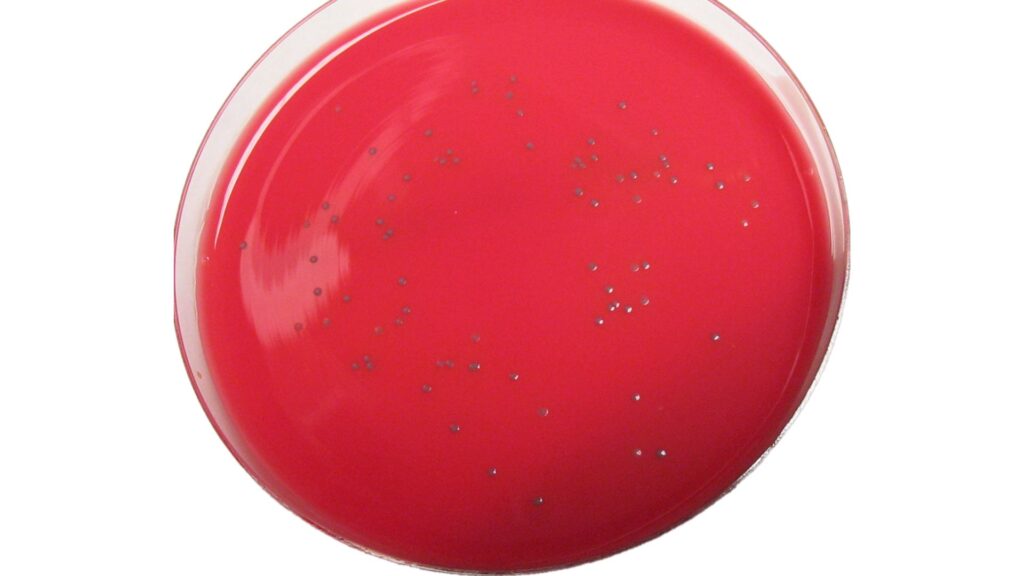 Listeria monocytogenes dans une boite de Petri // Source : Wikimédia
