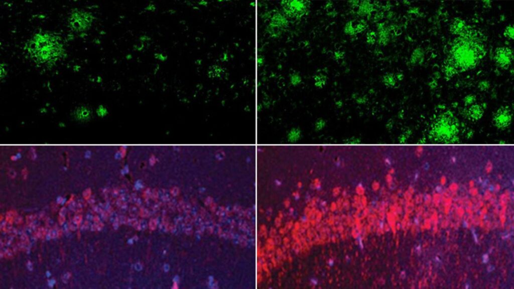 Modèle murin de la maladie d’Alzheimer. Rangée du haut : la carence en lithium (à droite) a augmenté considérablement les dépôts de bêta-amyloïde dans le cerveau, comparativement à des souris présentant des taux normaux de lithium (à gauche). Rangée du bas : Même chose pour la protéine tau, responsable de l’enchevêtrement des neurofibrille dans la maladie d’Alzheimer // Source : Yankner Lab