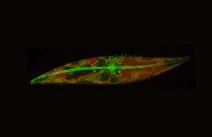 Image d'une diatomée arctique, montrant les filaments d'actine qui la parcourent et lui permettent de patiner.  // Source : Laboratoire Prakash