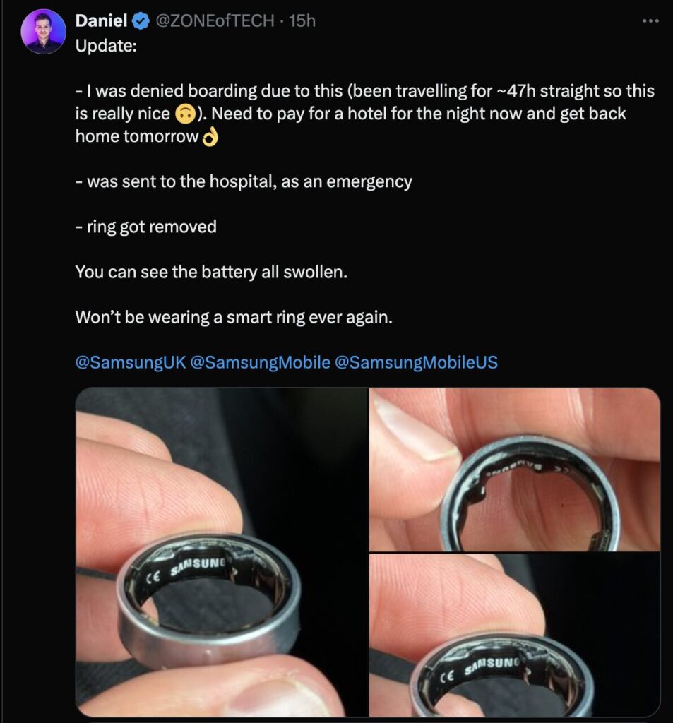 La batterie de la bague s'est complètement déformée. La batterie de la bague s'est complètement déformée.