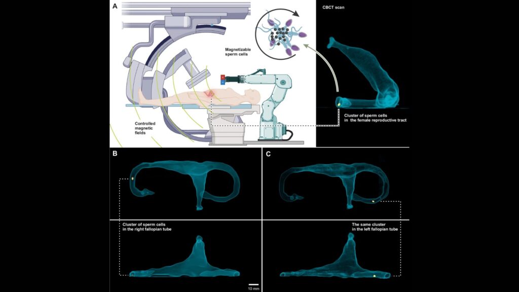 Microrobots biohybrides à base de sperme ciblant un traitement peu invasif dans l'appareil reproducteur féminin avec des champs magnétiques externes faibles, à basse fréquence et contrôlés et l'imagerie par fluoroscopie aux rayons X pour la localisation des grappes de spermatozoïdes magnétisables. // Source : npj Robotics (npj Robot)- ISSN 2731-4278 (online) Microrobots biohybrides à base de sperme ciblant un traitement peu invasif dans l'appareil reproducteur féminin avec des champs magnétiques externes faibles, à basse fréquence et contrôlés et l'imagerie par fluoroscopie aux rayons X pour la localisation des grappes de spermatozoïdes magnétisables. // Source : npj Robotics (npj Robot)- ISSN 2731-4278 (online)