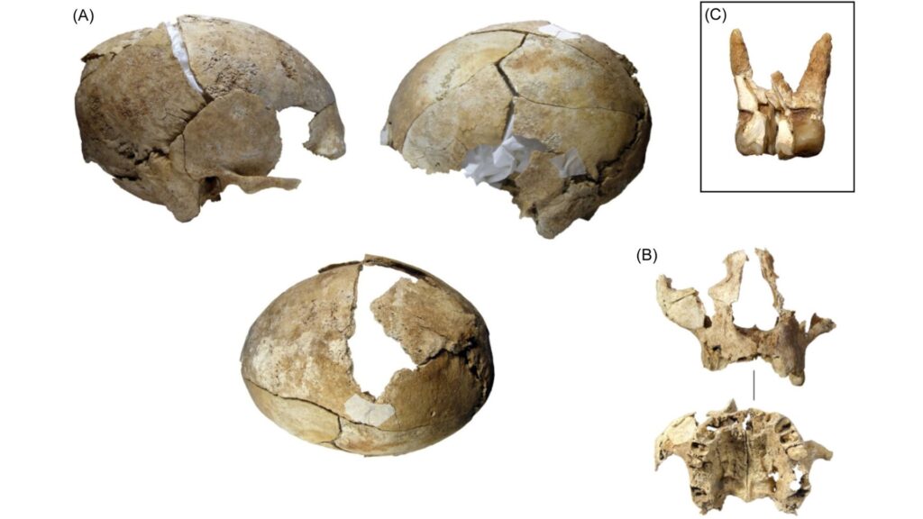 (A) Vues du crâne humain une fois reconstitué ; (B) Partie du visage du même individu ; (C) Détail d'une dent avec une cavité // Source : Silvia Carnicero