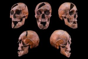 Crâne de l'individu étudié, provenant du monastère dominicain du XIIIe siècle situé sur l'île Marguerite à Budapest // Source : Université Eötvös Loránd