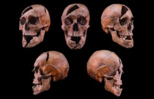 Crâne de l'individu étudié, provenant du monastère dominicain du XIIIe siècle situé sur l'île Marguerite à Budapest // Source : Université Eötvös Loránd