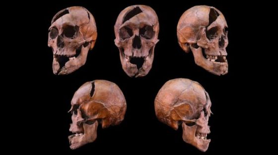 Crâne de l'individu étudié, provenant du monastère dominicain du XIIIe siècle situé sur l'île Marguerite à Budapest // Source : Université Eötvös Loránd