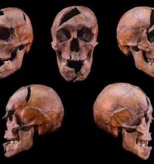 Crâne de l'individu étudié, provenant du monastère dominicain du XIIIe siècle situé sur l'île Marguerite à Budapest // Source : Université Eötvös Loránd Crâne de l'individu étudié, provenant du monastère dominicain du XIIIe siècle situé sur l'île Marguerite à Budapest // Source : Université Eötvös Loránd