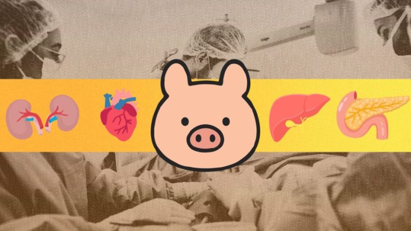 Xénogreffes : pourquoi le cochon est-il le meilleur ami de l’homme pour le don d’organe ? Xénogreffes : pourquoi le cochon est-il le meilleur ami de l’homme pour le don d’organe ?