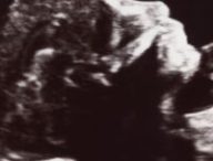 Source : Canva Source : Canva