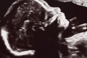 Source : Canva Source : Canva