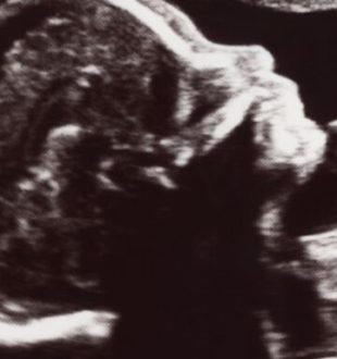 Source : Canva Source : Canva