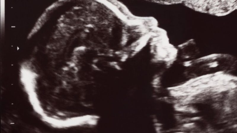 L’utérus artificiel relève de la S-F aujourd’hui, mais des recherches existent : les enjeux sont vertigineux L’utérus artificiel relève de la S-F aujourd’hui, mais des recherches existent : les enjeux sont vertigineux