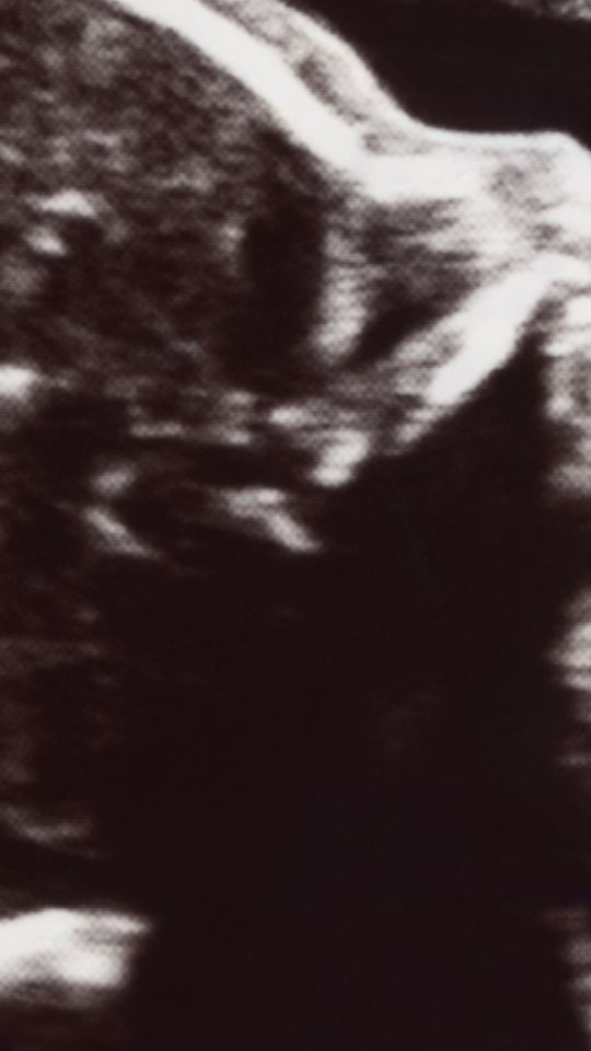 Source : Canva Source : Canva