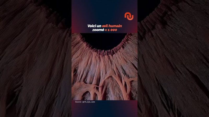 Voici ton œil zoomé 1000 fois ! Voici ton œil zoomé 1000 fois !