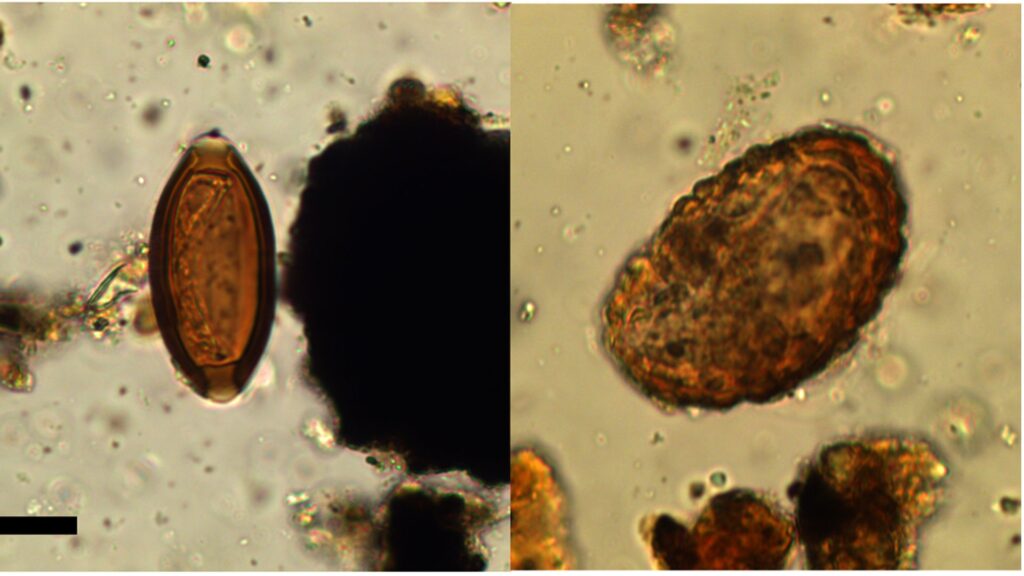&oelig;ufs de Trichuris sp. (gauche), Ascaris sp (droite). Deux des parasites retrouv&eacute;s, vus au microscope