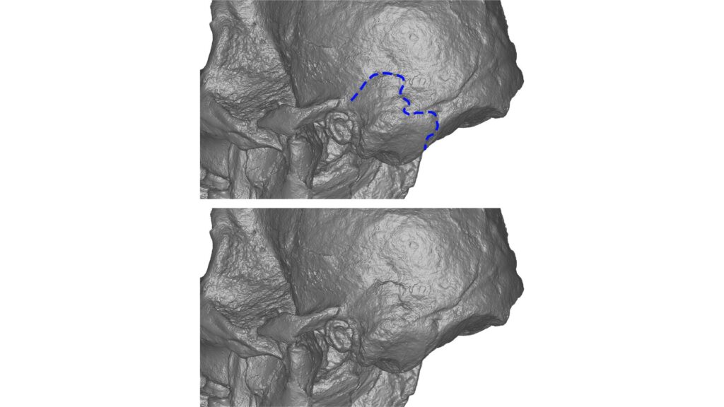 StW 573 (Little Foot) en vue lat&eacute;rale. La ligne bleue soulignant la pr&eacute;sence d'une encoche ast&eacute;rionique qui diff&egrave;re du sp&eacute;cimen de type d'A. prometheus (MLD 1) // Source : American Journal of Biological Anthropology 