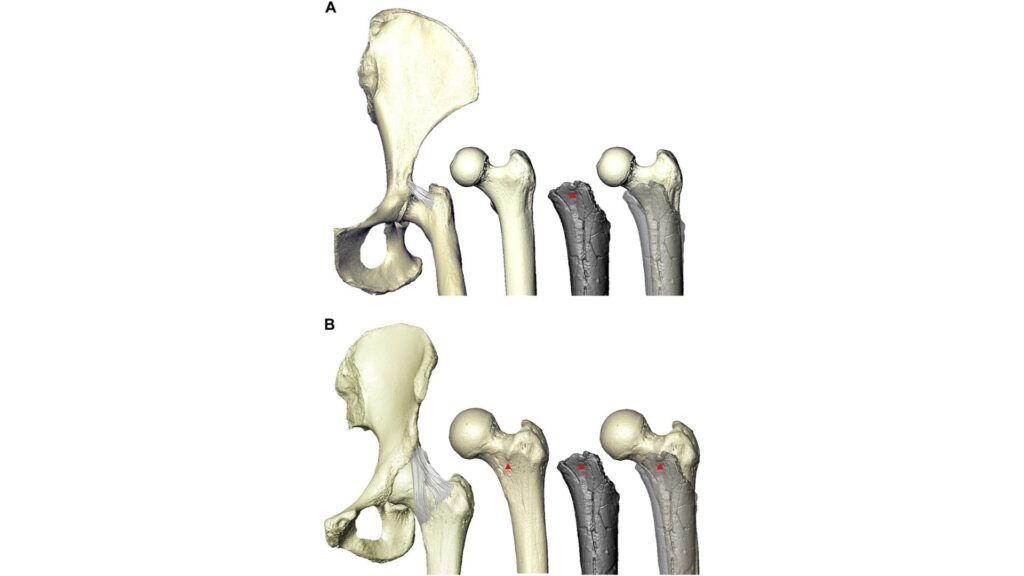 Le ligament ilio-fémoral chez le chimpanzé (A) et chez l'homme (B). Le tubercule fémoral (pointes de flèches rouges) correspond à l'insertion d'une partie du ligament ilio-fémoral. Le chimpanzé est représenté en gris, et un gris plus clair est superposé à l'homme pour indiquer la présence du tubercule fémoral, et à celui du chimpanzé pour en montrer l'absence. // Source : Sciences Advances Le ligament ilio-fémoral chez le chimpanzé (A) et chez l'homme (B). Le tubercule fémoral (pointes de flèches rouges) correspond à l'insertion d'une partie du ligament ilio-fémoral. Le chimpanzé est représenté en gris, et un gris plus clair est superposé à l'homme pour indiquer la présence du tubercule fémoral, et à celui du chimpanzé pour en montrer l'absence. // Source : Sciences Advances