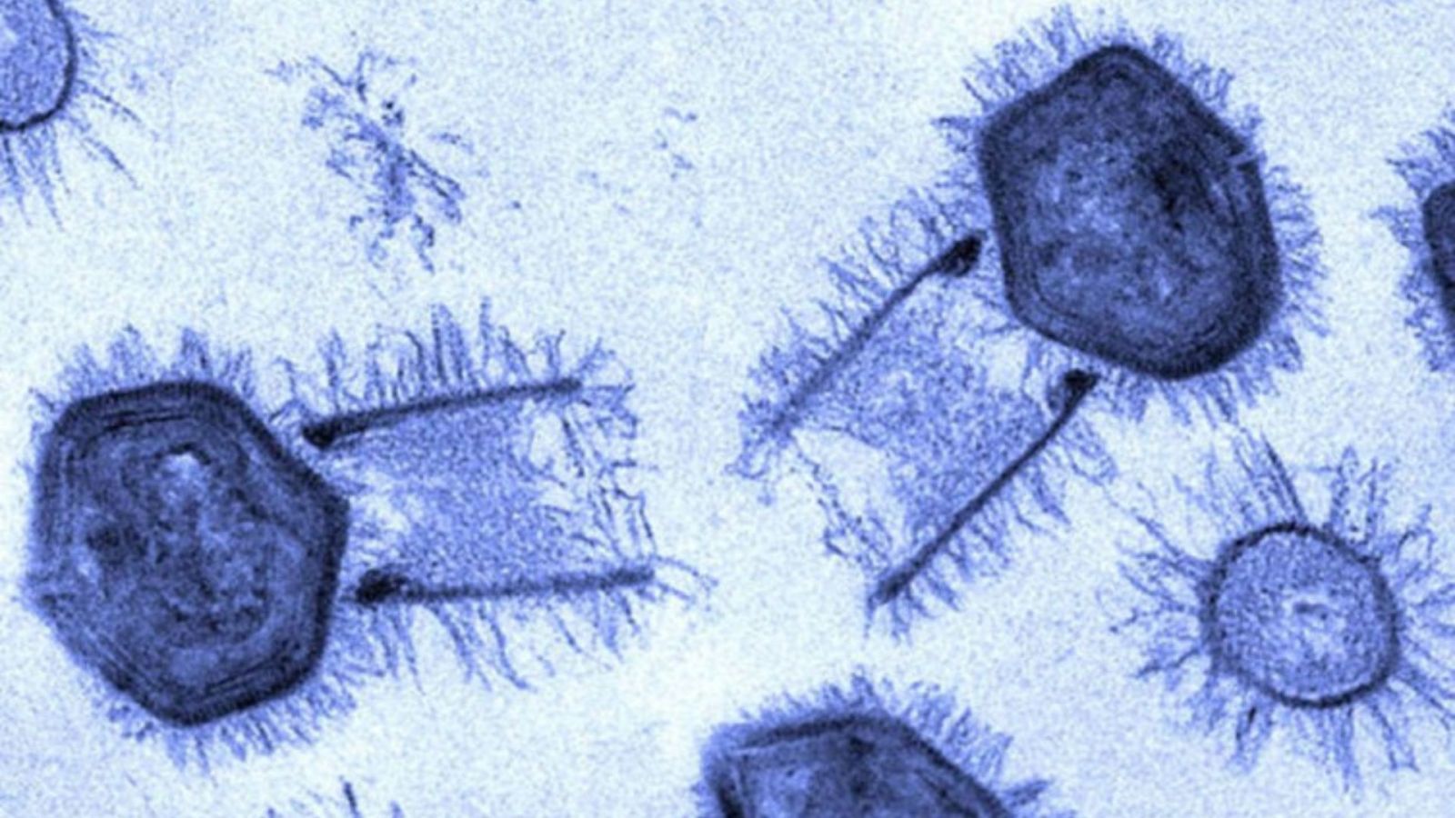 Un nouveau virus géant contient peut-être la clé de l’origine de la vie