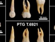 Échantillon dentaire analysé. // Source : PLOS (image recadrée)