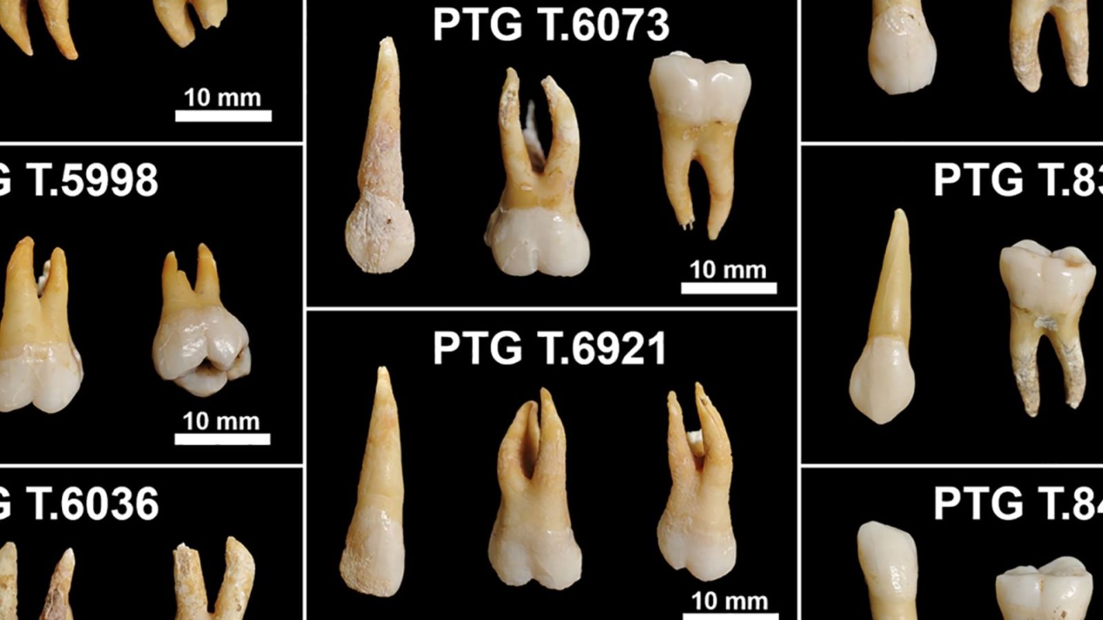Ces dents de l’âge du fer ont enregistré tout ce que leurs propriétaires ont vécu