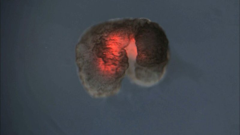 Que sont les xénobots, ces robots biologiques qui bouleversent les frontières entre vivant et machine&nbsp;?