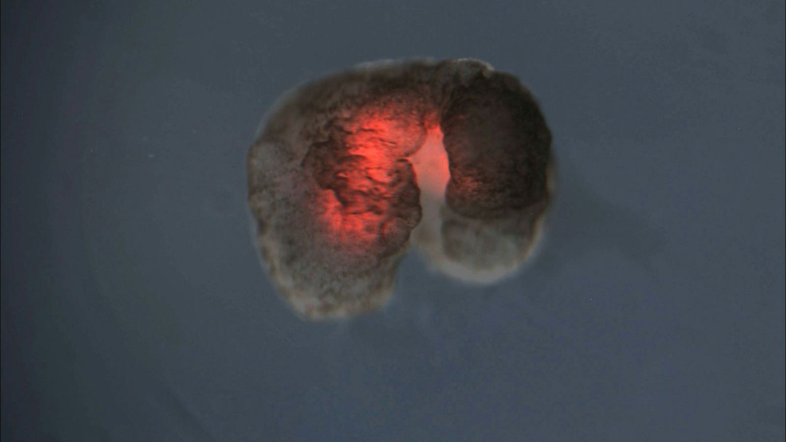 Que sont les xénobots, ces robots biologiques qui bouleversent les frontières entre vivant et machine ?