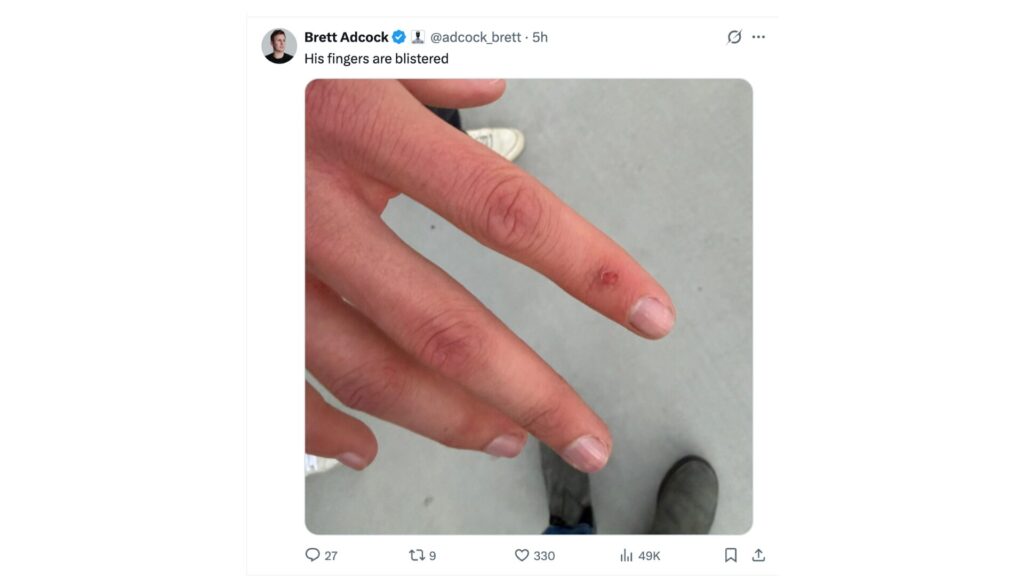 Aime n'est pas ressorti totalement indemne... // Source : Brett Adcock sur X