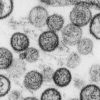 Hantavirus. // Source : Institut Pasteur